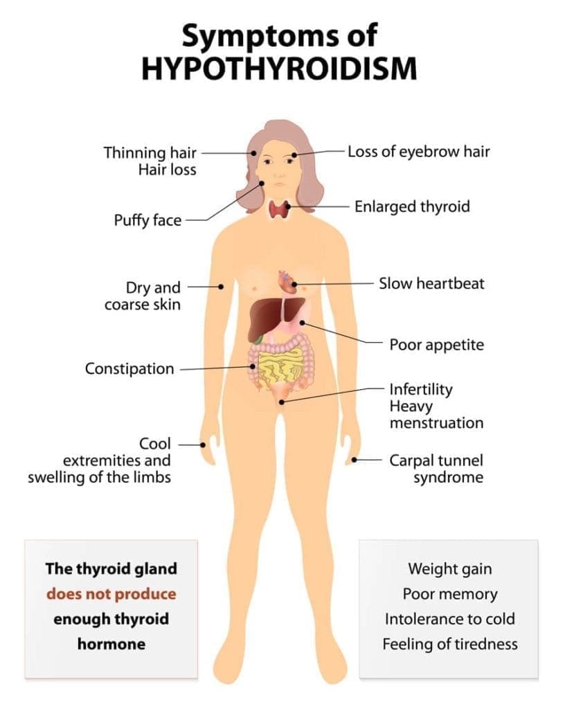 thyroid-testing-issues-why-you-re-undiagnosed-or-ineffectively-treated