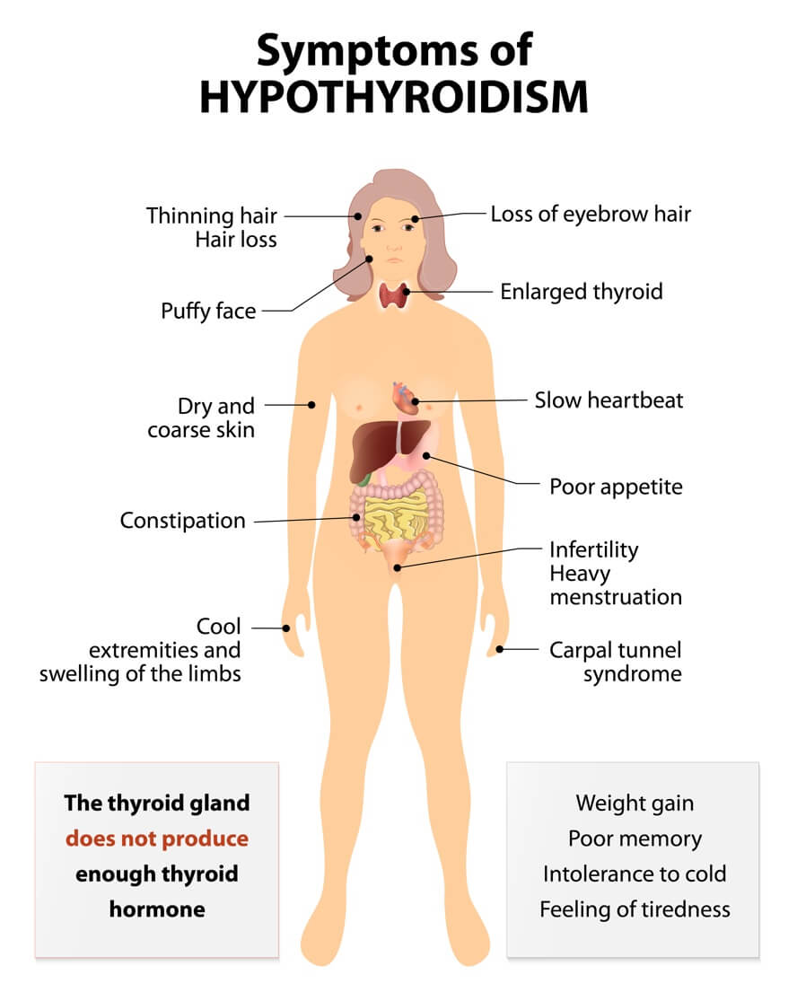Hashimoto's Hypothyroidism: Autoimmune Disease: Signs & Symptoms Your Body Is Attacking Itself + Treatments | Dr. Jiwani's Naturopathic Nuggets Blog